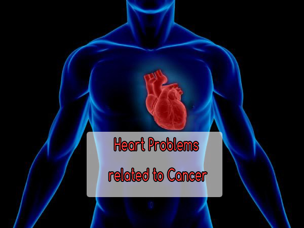 Heart Problems related to Cancer